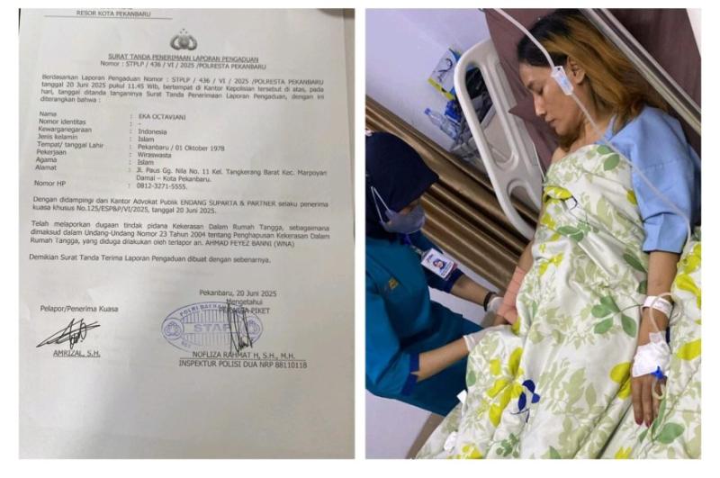 Tak Tahan Dianiaya Suami Bule, IRT Lapor Ke Polresta Pekanbaru, Berharap Ditindaklanjuti